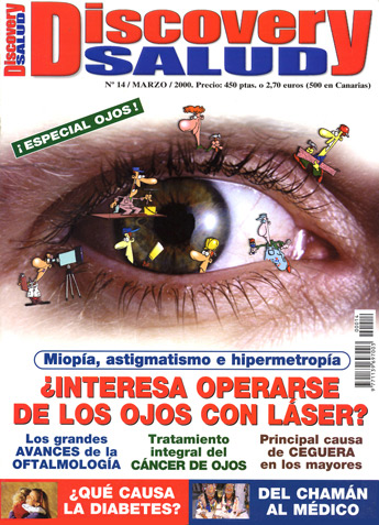 Operaciones Con Laser A La Vista